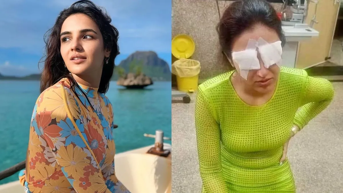 jasmine-bhasin-opens-up-about-her-pain-during-corneal-damage-says-it-used-to-be-difficult
